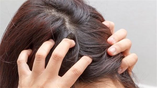 فروة الرأس المحروقة من الشمس.. خطر غير مرئي يهدد الصحة الجلدية فروة الرأس المحروقة من الشمس.. خطر غير مرئي يهدد الصحة الجلدية