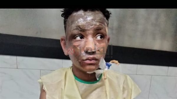سيف ضحية انفجار الواحات أثناء ذهابه للعمل: كنت رايح الشغل.. وفجأة الدنيا ولعت