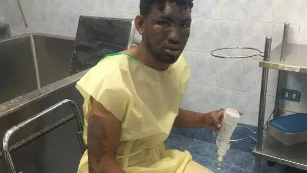 مصدر بالصحة: حالة أحمد مصطفى مصاب حادث انفجار خط غاز الواحات مستقرة.. ولا حاجة لنقله من مستشفى إمبابة مصدر بالصحة: حالة أحمد مصطفى مصاب حادث انفجار خط غاز الواحات مستقرة.. ولا حاجة لنقله من مستشفى إمبابة
