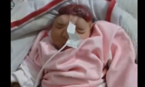 صدمة في غزة.. ولادة طفلة “بلا دماغ” ومطالب بالتحقيق في الأسلحة التي تستخدمها إسرائيل بحرب الإبادة.. (صورة/فيديو) صدمة في غزة.. ولادة طفلة “بلا دماغ” ومطالب بالتحقيق في الأسلحة التي تستخدمها إسرائيل بحرب الإبادة.. (صورة/فيديو)