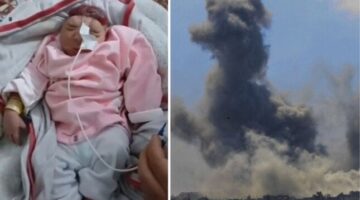ولادة طفلة بلا دماغ مع تزايد ظاهرة "تشوه الأجنة" في قطاع غزة
