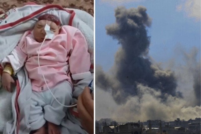 ولادة طفلة بلا دماغ مع تزايد ظاهرة "تشوه الأجنة" في قطاع غزة ولادة طفلة بلا دماغ مع تزايد ظاهرة "تشوه الأجنة" في قطاع غزة