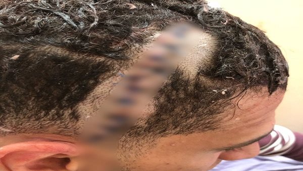 شق رأس حلاق أمام زوجته.. تفاصيل سحل شاب في بني سويف شق رأس حلاق أمام زوجته.. تفاصيل سحل شاب في بني سويف