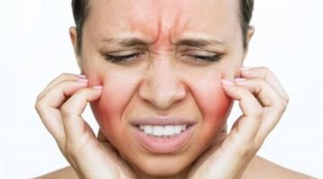 انتفاخ الوجه المستمر.. تعرف على أسبابه وطرق العلاج