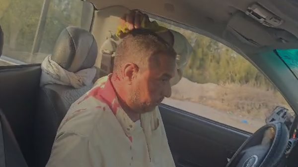 بسلاح ناري.. مجهولون يعتدون على صاحب مزرعة وعامل بطريق إسكندرية الصحراوي بسلاح ناري.. مجهولون يعتدون على صاحب مزرعة وعامل بطريق إسكندرية الصحراوي