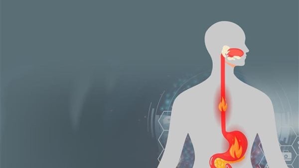 أبزرها تناول الأطعمة الغنية بالألياف.. طرق لتقليل أعراض ارتجاع المريء أبزرها تناول الأطعمة الغنية بالألياف.. طرق لتقليل أعراض ارتجاع المريء