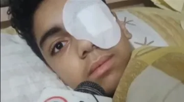 محمد ضحية زميله في الغربية: ضربني بالسيراميكا في عيني عشان رفضت أخليه يلعب كورة معايا