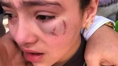 تصالح بين أسرة الطفلة “حنين” والمعلم بعد إصابتها في عينها داخل مدرسة بالدقهلية تصالح بين أسرة الطفلة “حنين” والمعلم بعد إصابتها في عينها داخل مدرسة بالدقهلية