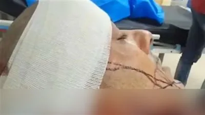 محاولة سرقة تنتهي بجريمة طعن.. إصابة شاب بـ21 غرزة والمتهم ما زال هاربًا ويُهدد المجني عليه محاولة سرقة تنتهي بجريمة طعن.. إصابة شاب بـ21 غرزة والمتهم ما زال هاربًا ويُهدد المجني عليه