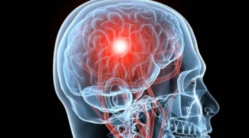 دراسة حديثة تنبه: العمل لساعات طويلة في الأسبوع قد يؤدي إلى أضرار في الدماغ