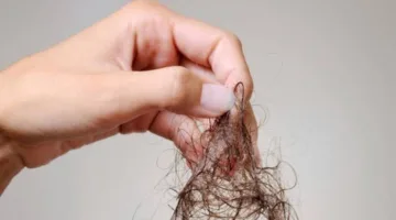 مواد طبيعية لتعزيز صحة الشعر وحمايته من التقصف والتكسر