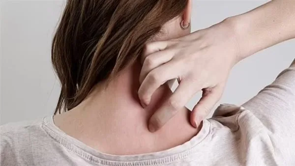 علامات غير ظاهرة على الجلد تدل على الإصابة بداء السكري علامات غير ظاهرة على الجلد تدل على الإصابة بداء السكري
