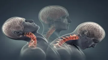 أعراض تنذرك بالإصابة بإرتجاج الدماغ.. انتبه لها
