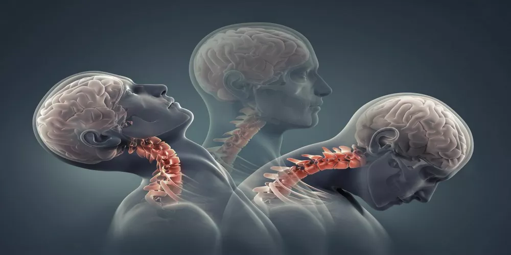 أعراض تنذرك بالإصابة بإرتجاج الدماغ.. انتبه لها أعراض تنذرك بالإصابة بإرتجاج الدماغ.. انتبه لها