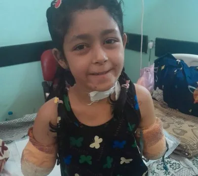 إسرائيل قطعت ذراعيها.. سارة البرش طفلة غزية ترسم الحياة بقدميها إسرائيل قطعت ذراعيها.. سارة البرش طفلة غزية ترسم الحياة بقدميها