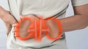 احذرها.. 3 أطعمة يجب تجنبها للحفاظ على صحة الكلى
