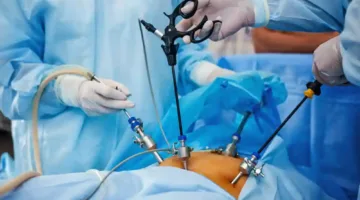 استئصال ورم في العمود الفقري لأول مرة بإستخدام المنظار