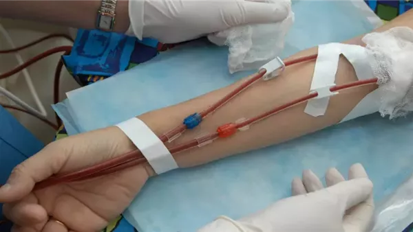 الصحة: تنفيذ أكثر من مليون و600 ألف جلسة غسيل كلوي مميكنة حتى الآن الصحة: تنفيذ أكثر من مليون و600 ألف جلسة غسيل كلوي مميكنة حتى الآن