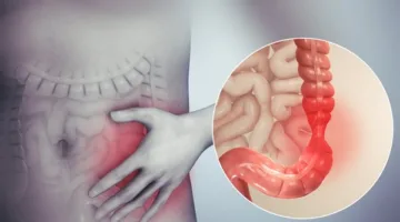 باحثة: التغذية والرياضة تخففان أعراض القولون العصبي لدى الطلاب خلال الامتحانات