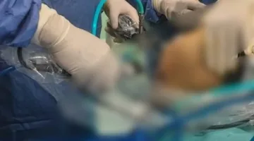 جلطة حادة بالشريان الرئوي.. نص تقرير الطب الشرعي لحفيدة رئيس الوزراء الأسبق المتوفاة بسبب حقنة فيلر