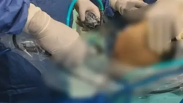 جلطة حادة بالشريان الرئوي.. نص تقرير الطب الشرعي لحفيدة رئيس الوزراء الأسبق المتوفاة بسبب حقنة فيلر جلطة حادة بالشريان الرئوي.. نص تقرير الطب الشرعي لحفيدة رئيس الوزراء الأسبق المتوفاة بسبب حقنة فيلر