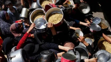 أكثر من 70 ألف طفل في غزة يعانون من حالات متقدمة من نقص التغذية