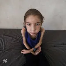 رهف عياد.. طفلة تنهشها الإبادة في غزة وسط عجز طبي وحصار خانق رهف عياد.. طفلة تنهشها الإبادة في غزة وسط عجز طبي وحصار خانق
