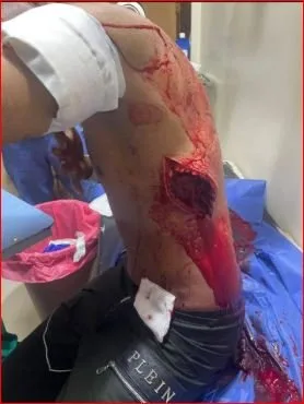 شجار عنيف أسفر عنAttempted Murder لطالب.. ما الذي حدث في العبور؟ شجار عنيف أسفر عنAttempted Murder لطالب.. ما الذي حدث في العبور؟