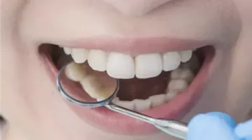 طرق صحية وطبيعية لتبييض الأسنان.. ابتسامة ناصعة بدون مواد كيميائية