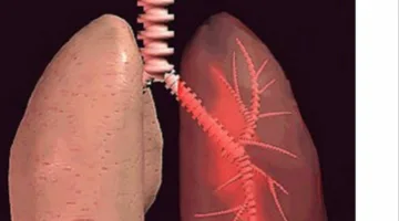 علامات تحذيرية .. اكتشف أعراض سرطان الرئة سريعا