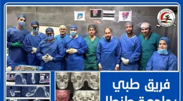 لاستئصال ورم خبيث بالفك .. فريق طبي بجامعة طنطا يجري جراحة معقدة لسيدة