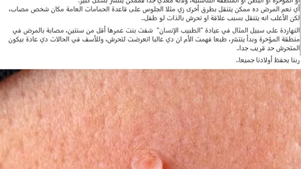 محمد الناظر يكشف علامات مرضية تظهر للأطفال عند تعرضهم للتحرش محمد الناظر يكشف علامات مرضية تظهر للأطفال عند تعرضهم للتحرش