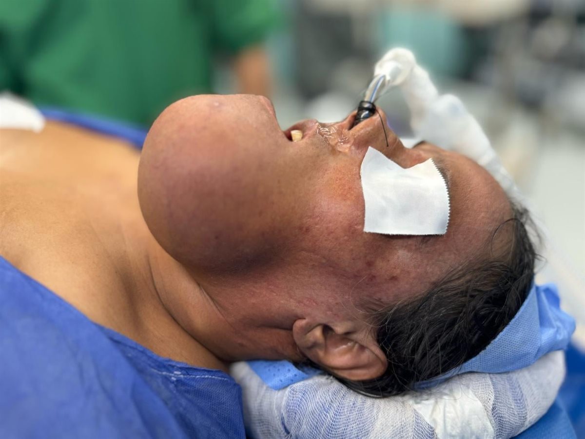 نجاح جراحة دقيقة لإزالة ورم من فك مريضة بمستشفى الشيخ زايد التخصصي نجاح جراحة دقيقة لإزالة ورم من فك مريضة بمستشفى الشيخ زايد التخصصي