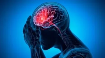 نصائح لتقليص خطر الإصابة بالخرف والاكتئاب والسكتة الدماغية، ومن أبرزها ممارسة الرياضة.