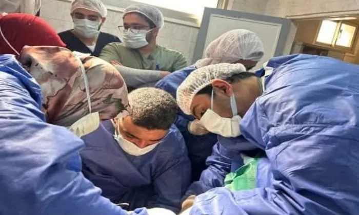إنقاذ حياة مريض مصاب بالغرغرينا في القولون والأمعاء الدقيقة بمستشفى بنها الجامعي