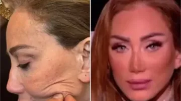 الإعلاميون يستقبلون شكوى من طبيب تجميل لبناني ضد ريهام سعيد