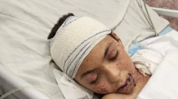 إيطاليا ستستضيف طفلًا فلسطينيًا نجا من الغارات الإسرائيلية الأسبوع المقبل