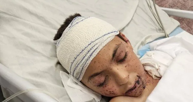 إيطاليا ستستضيف طفلًا فلسطينيًا نجا من الغارات الإسرائيلية الأسبوع المقبل إيطاليا ستستضيف طفلًا فلسطينيًا نجا من الغارات الإسرائيلية الأسبوع المقبل