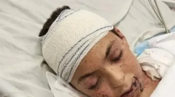 إيطاليا تعد نفسها لاستقبال طفل فلسطيني ناجٍ من الغارات الإسرائيلية الأسبوع المقبل.