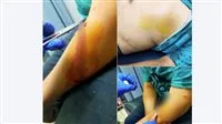 فشل في السرقة.. شاب عاطل يؤدي لنقل طالب إلى المستشفى في العبور