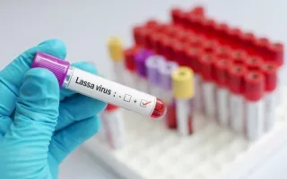 باحثون نيجيريون يبتكرون لقاحًا حديثًا لمكافحة حمى “لاسا”