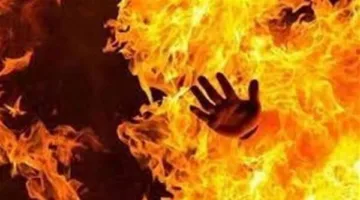 حالة طارئة: شاب يُحرق جسده داخل منزله في أوسيم