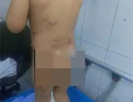 فيديو لطفل مصاب يُشعل الجدل مجددًا: “هل تعتبر الكلاب الضالة أغلى ما نملك في الأردن؟” الضحايا في تزايد والحكومة بلا رد.