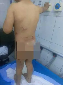 فيديو لطفل مصاب يُشعل الجدل مجددًا: “هل تعتبر الكلاب الضالة أغلى ما نملك في الأردن؟” الضحايا في تزايد والحكومة بلا رد. فيديو لطفل مصاب يُشعل الجدل مجددًا: “هل تعتبر الكلاب الضالة أغلى ما نملك في الأردن؟” الضحايا في تزايد والحكومة بلا رد.
