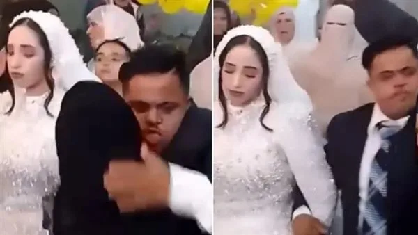 عاجل.. زفاف شخص يعاني من متلازمة داون يثير الجدل.. “المأذونون الشرعيون” يشرحون الحُكم الشرعي لـ “مصر تايمز”
