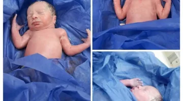 ولادة غير مألوفة لثلاثة توائم في مستشفى العدوة المركزي بالمنيا.. صور