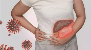 علامات تدل على مشاكل في الكبد