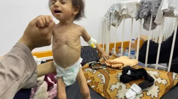 آلاء المقيد: الجوع في قطاع غزة كتهديد حتمي والمخاطر المستمرة التي تواجه الأجيال القادمة