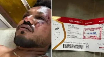 الناجي الفريد من حادثة تحطم الطائرة الهندية يشارك تفاصيل “المأساة”