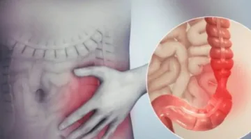 على الرغم من فوائده الرائعة.. هؤلاء لا يجب عليهم تناول القرنفل